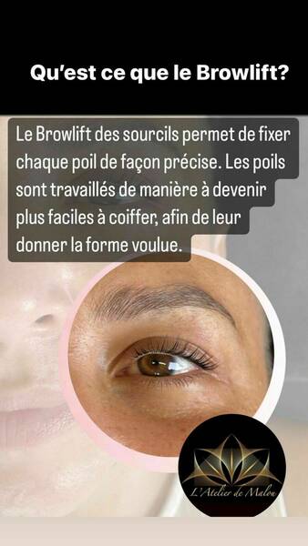 Browlift Sourcils